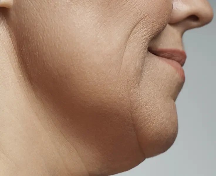 Close-up of a person's chin and lower face showing smooth skin and lips.