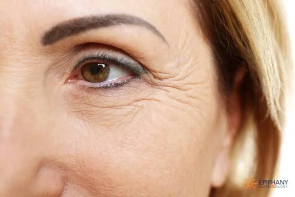Close-up of an older woman's eye showing signs of aging such as wrinkles and fine lines.