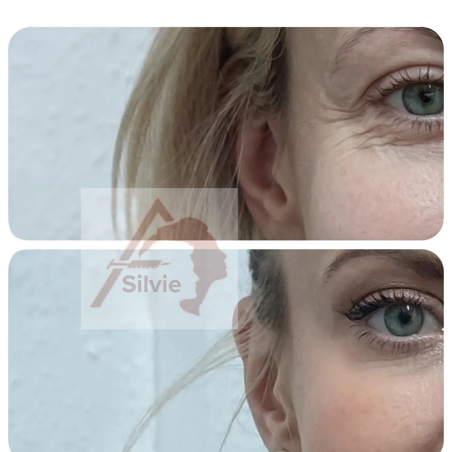 Close-up of a woman's face focusing on her eye, with red hair and light skin, positioned near the right edge of the image. The background is light-colored. The brand logo and name 'Silvie' are overlaid on the lower middle part of the image.