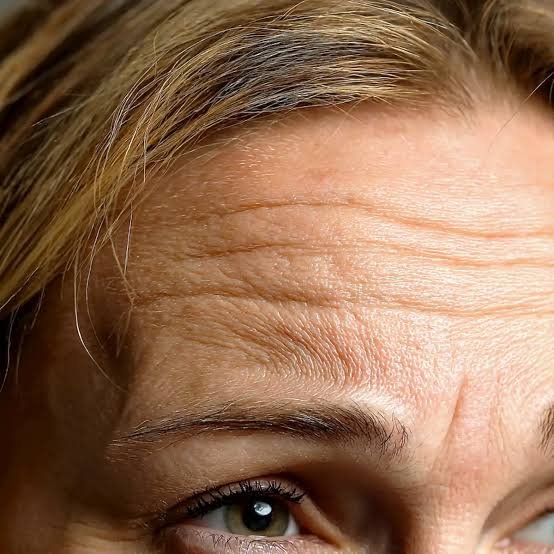 Close-up of a woman's forehead and eye, showing visible wrinkles and fine lines.