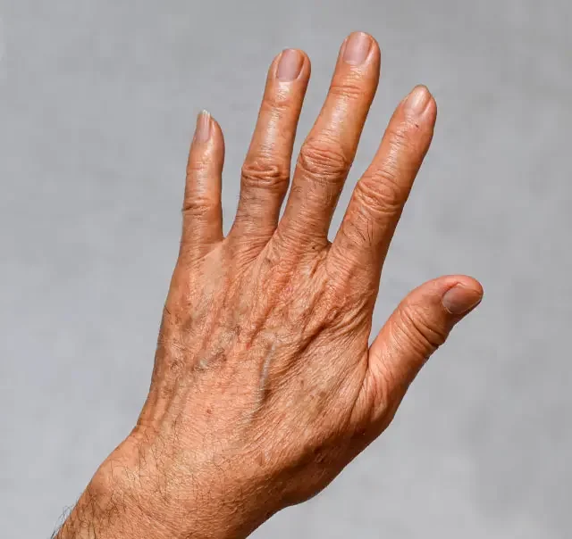 Close-up of a person's left hand with visible veins and wrinkles, fingers slightly spread apart against a plain gray background.