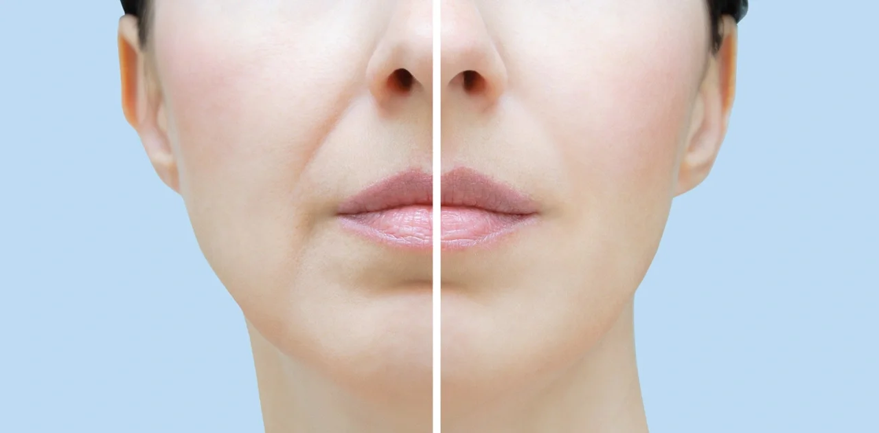 Close-up of a woman's face split into two halves, illustrating the before and after effects of cosmetic or skincare treatment.