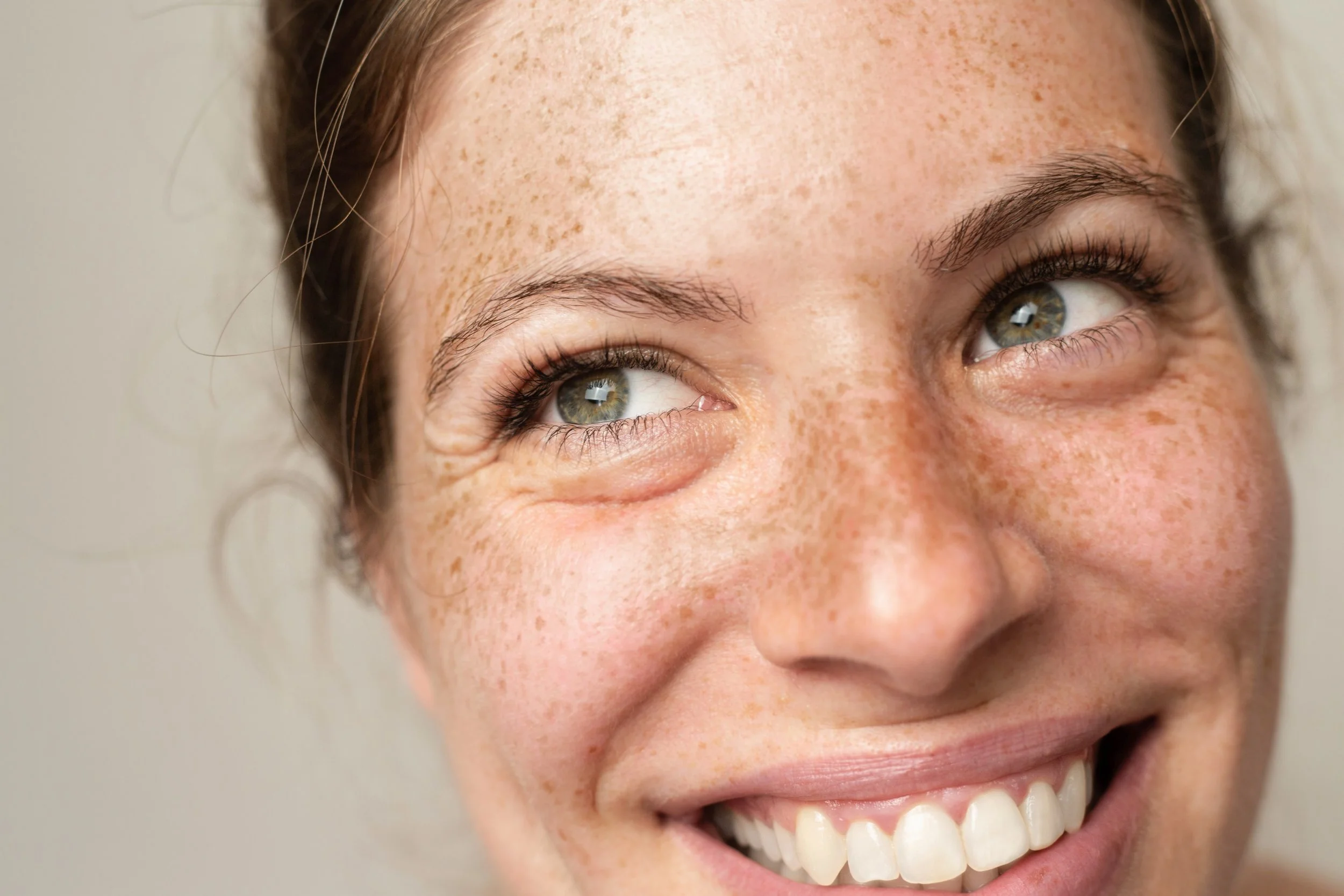 Close-up portrait representing natural skin quality, natural aestehtics and healthy ageing at DR GRŪN private medical practice in Berlin.