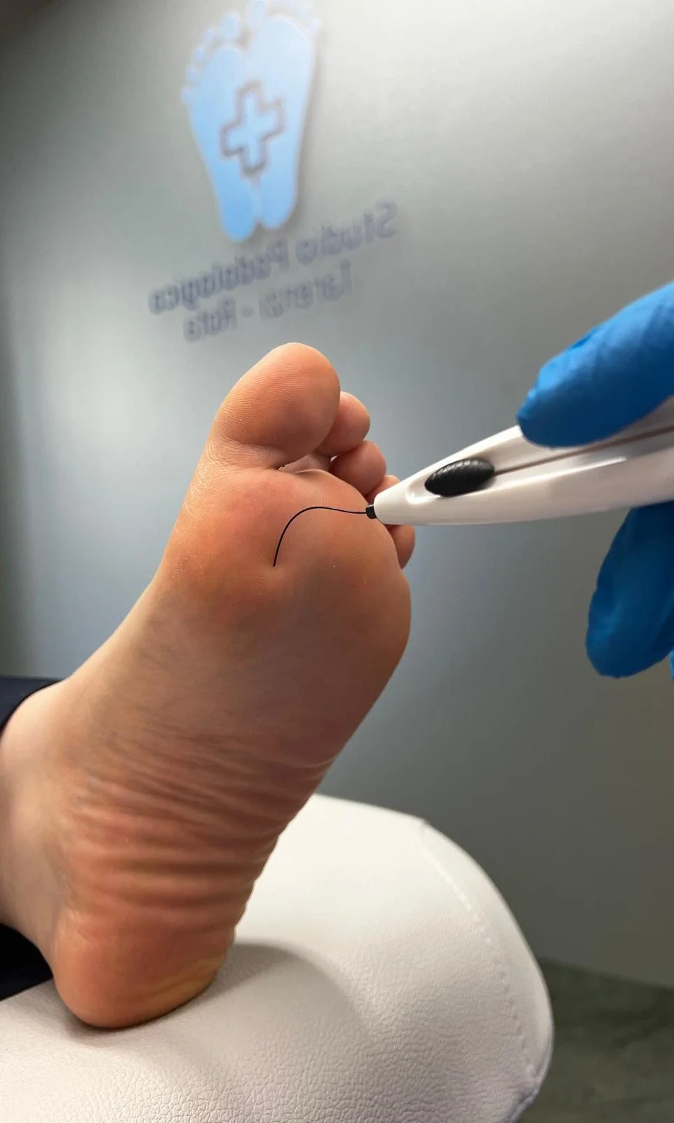 Test monofilamento prevenzione Studio Podologico Tarenzi - Rota