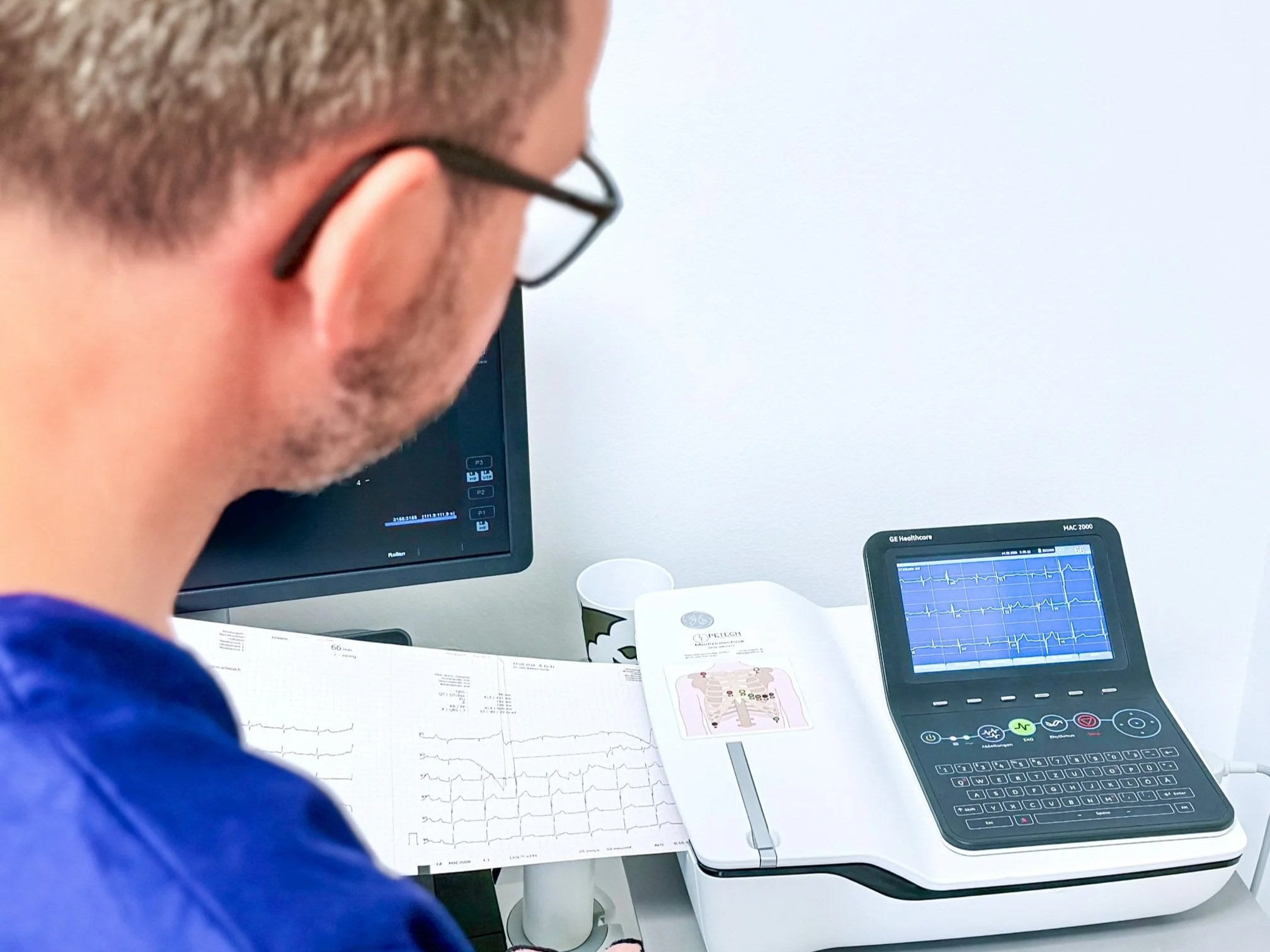 EKG