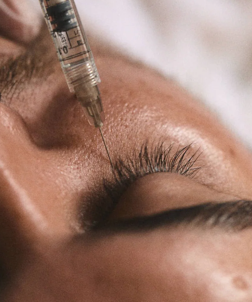 Close-up of a person's closed eye during an aesthetic procedure
