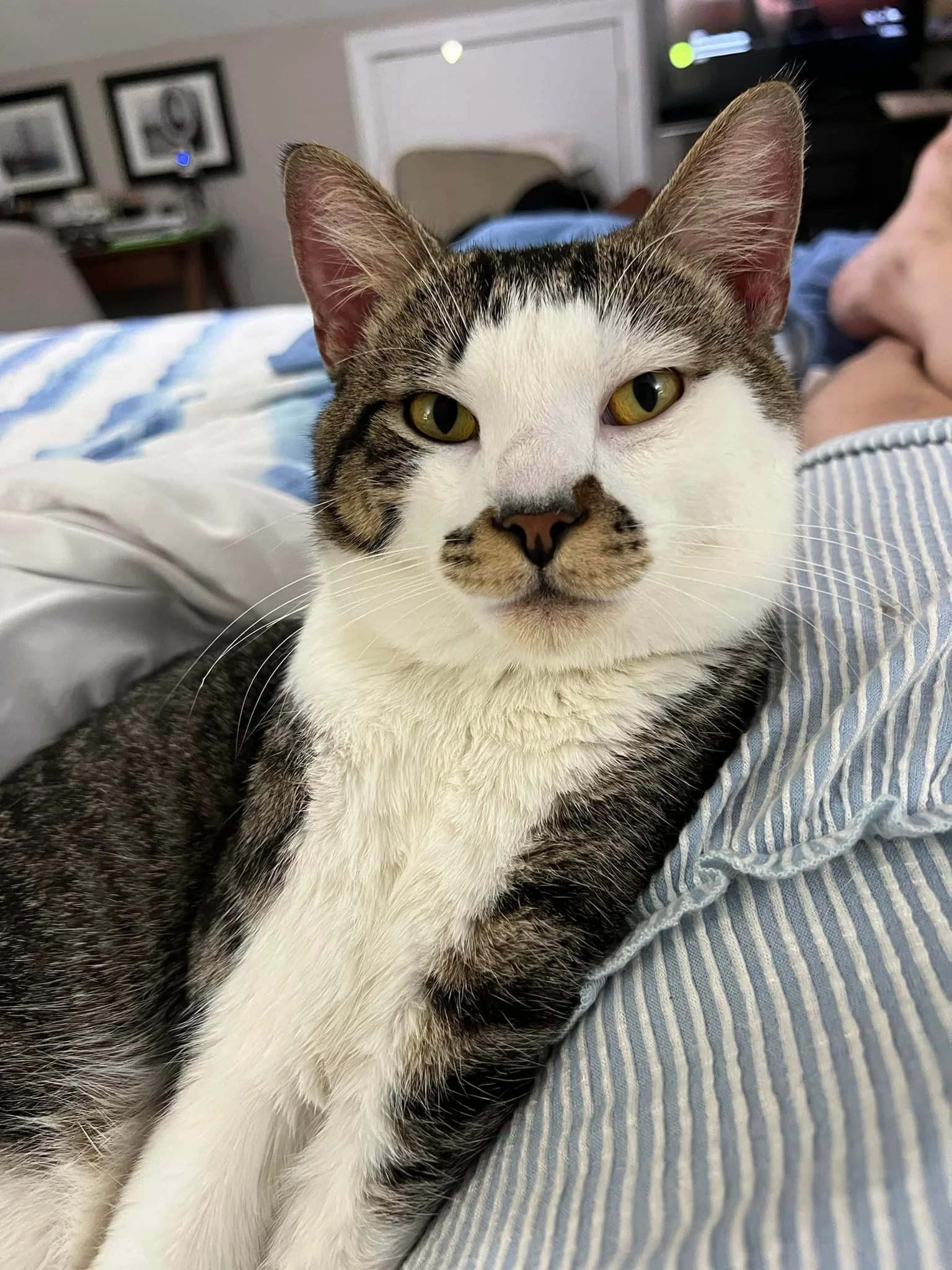 A close-up of a white and tabby cat lying on a striped blue and white blanket, looking directly at the camera.