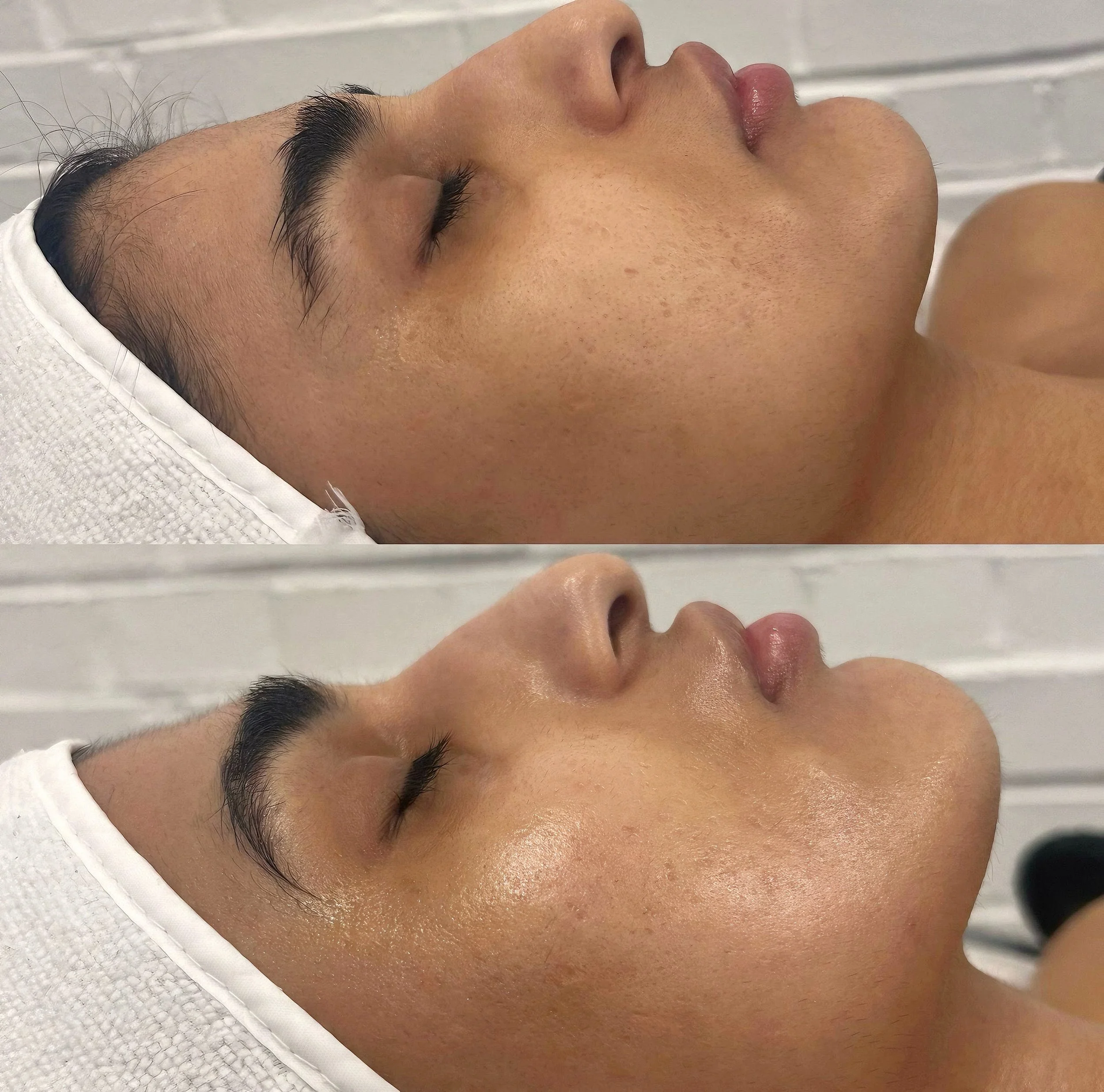 Close-up of a person's face with closed eyes, showing natural skin texture and eyebrows, lying down with a white headband.