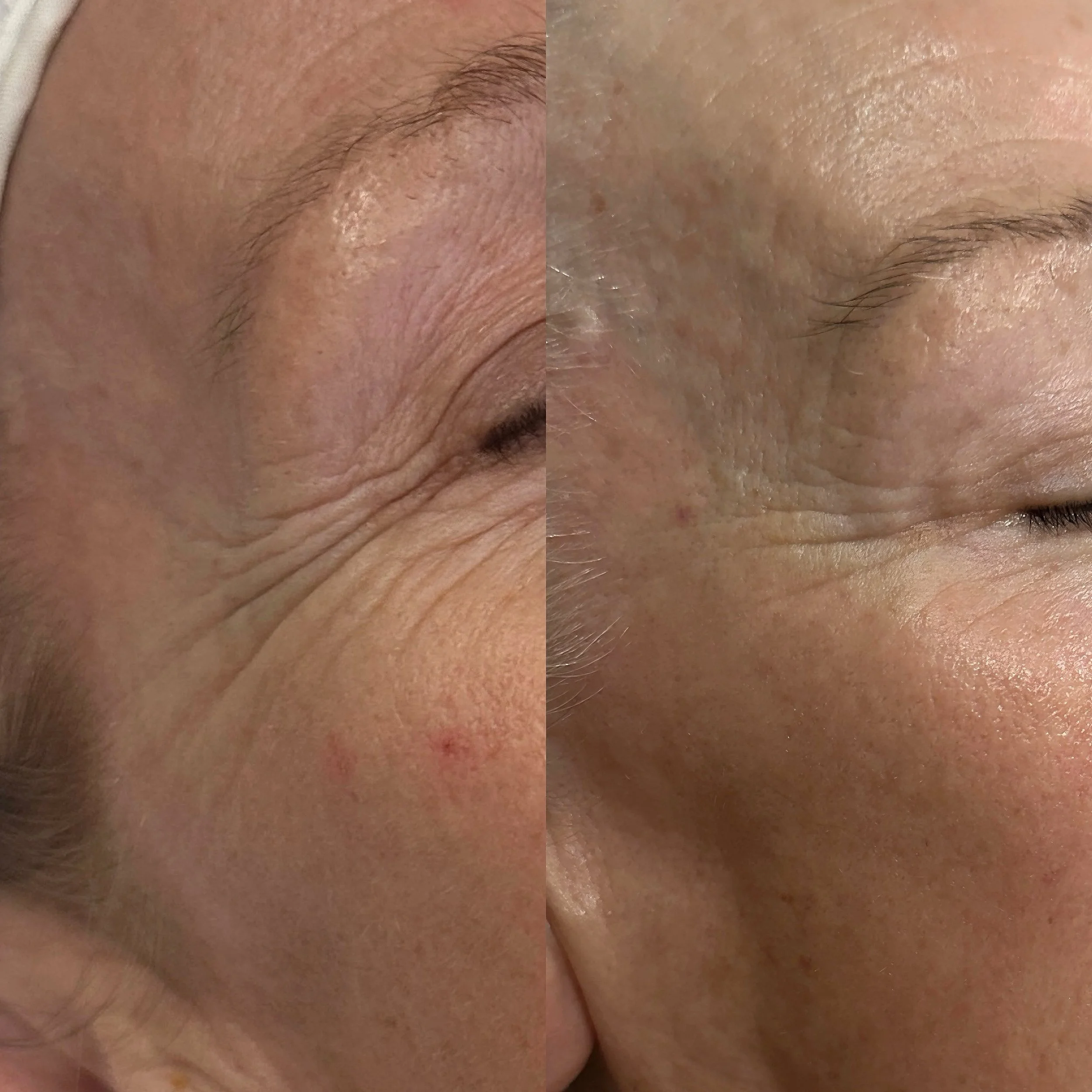 Close-up image of a person's skin with wrinkles and pores.