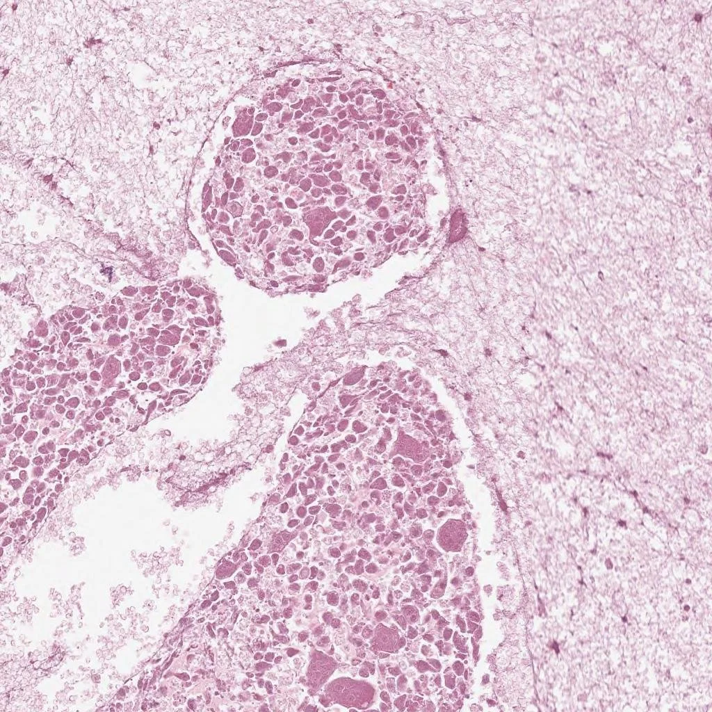 Classification of Histopathology Slides with Persistent Homology Convolutions