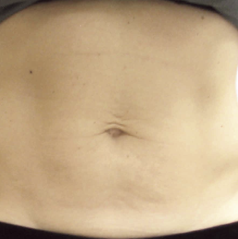 Close-up of a person's midsection showing bare skin and a small belly button.