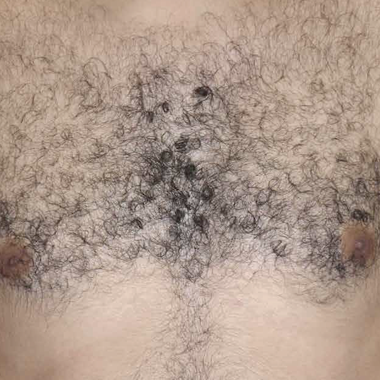 Close-up of a man's chest with dense, curly black chest hair.