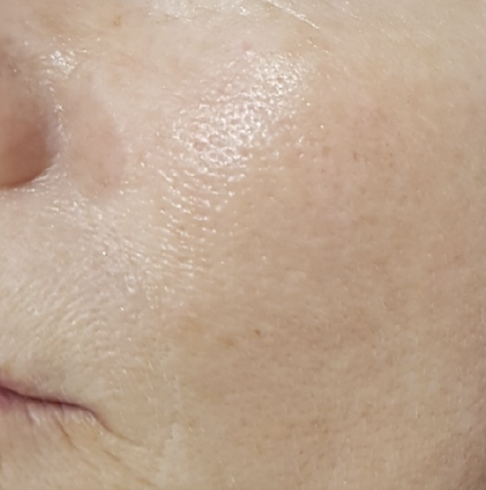 Close-up of a person's cheek and part of the nose, showing smooth skin with some visible pores.