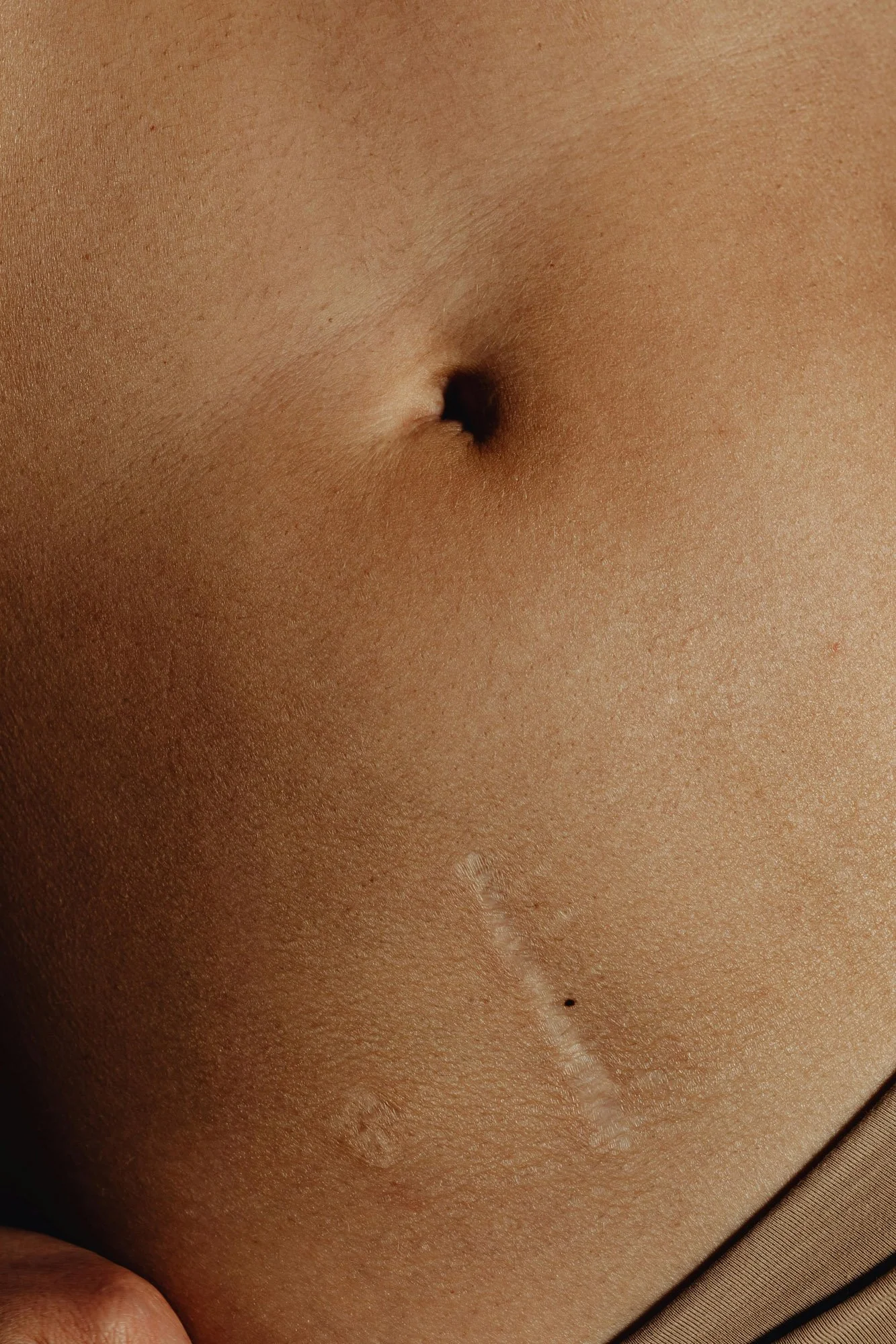 Zoom sur le nombril d'une personne avec la peau bronzée et quelques grains de beauté.