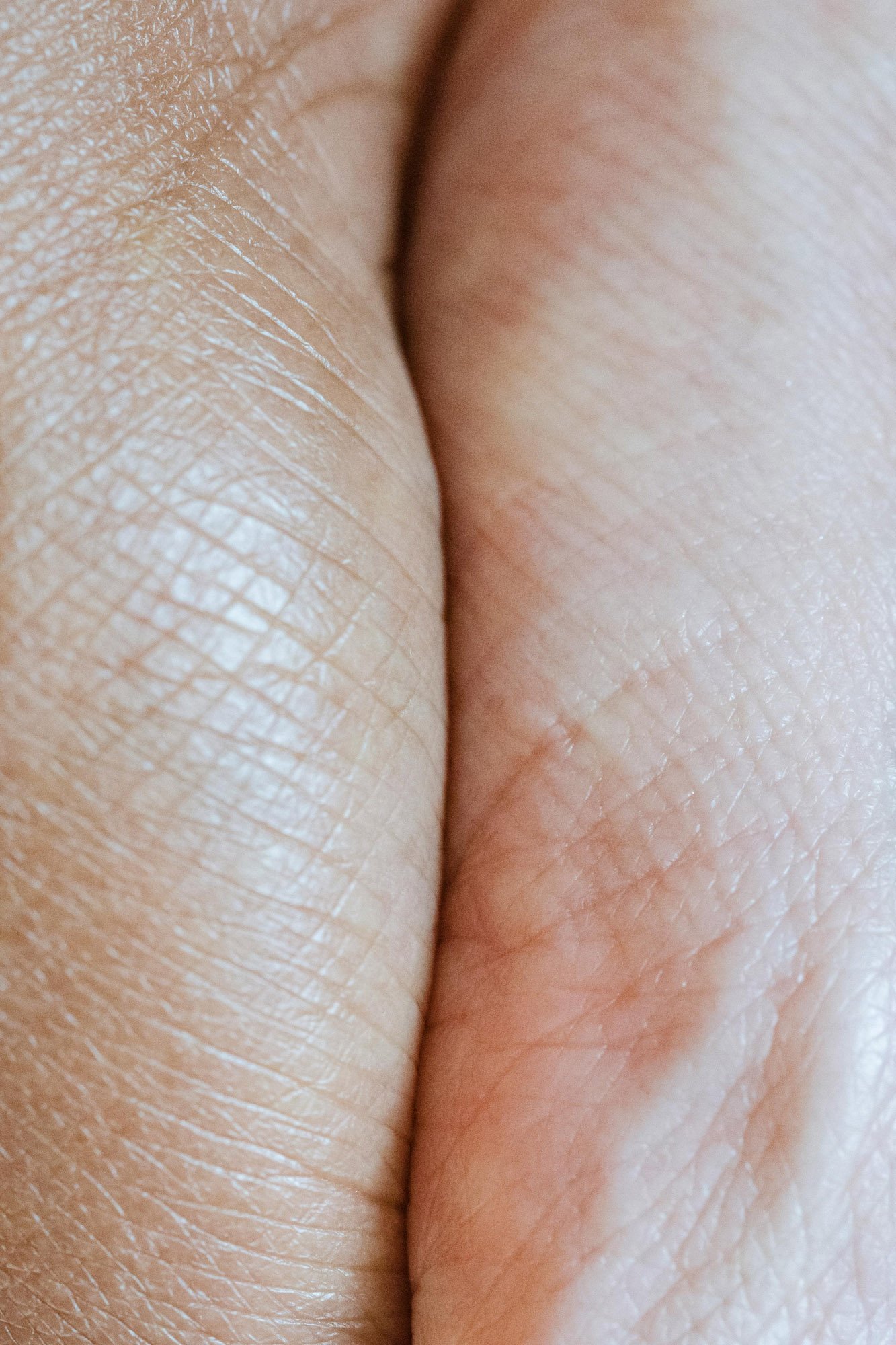 Gros plan de la peau humaine, montrant la texture et les détails de la surface cutanée.