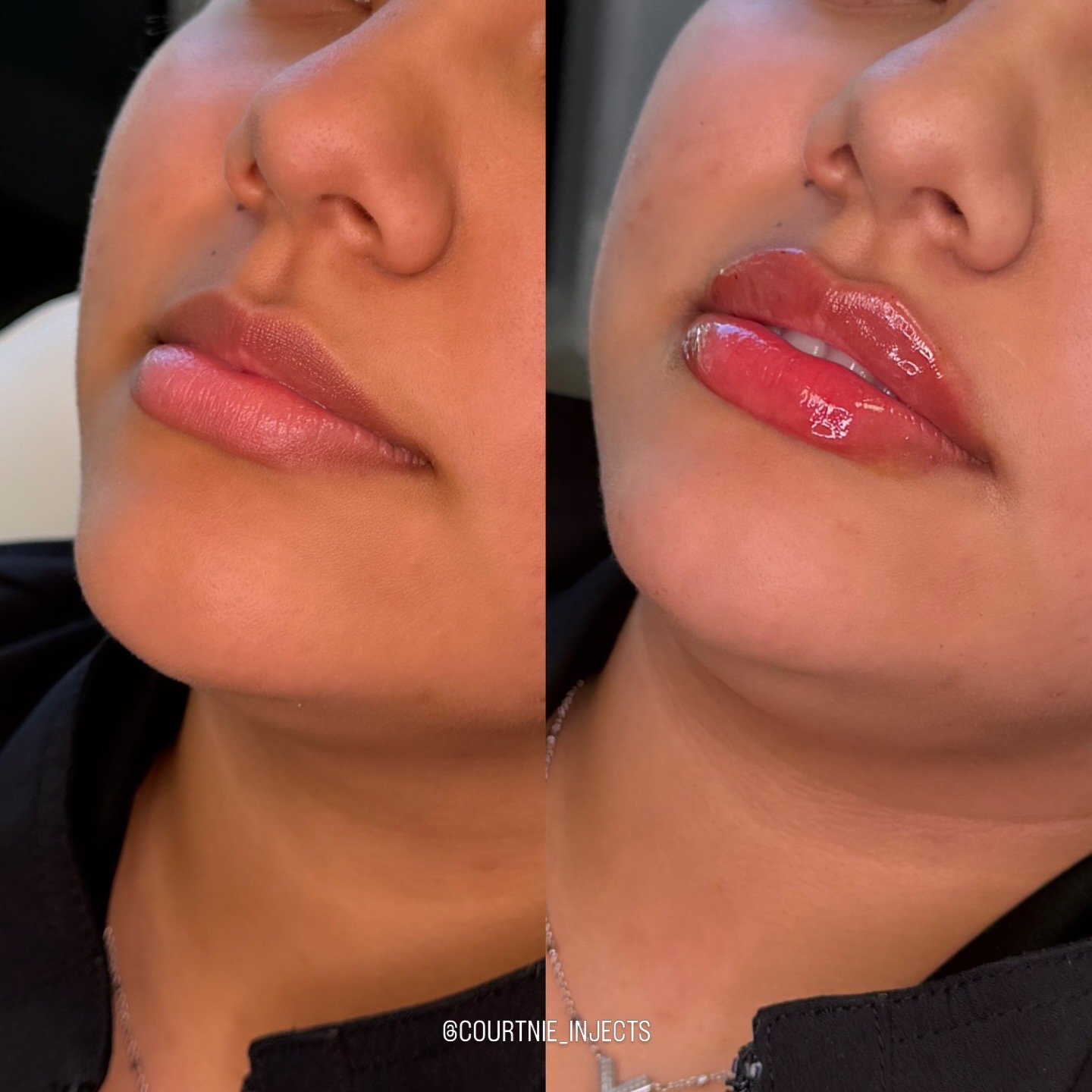 Close-up of a woman's face showing before and after the application of glossy, pink lip gloss.