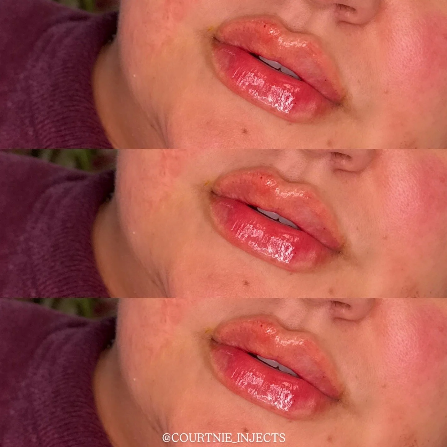 Close-up of a person's lips with shiny, plump, and slightly parted lips, repeated three times in a collage.