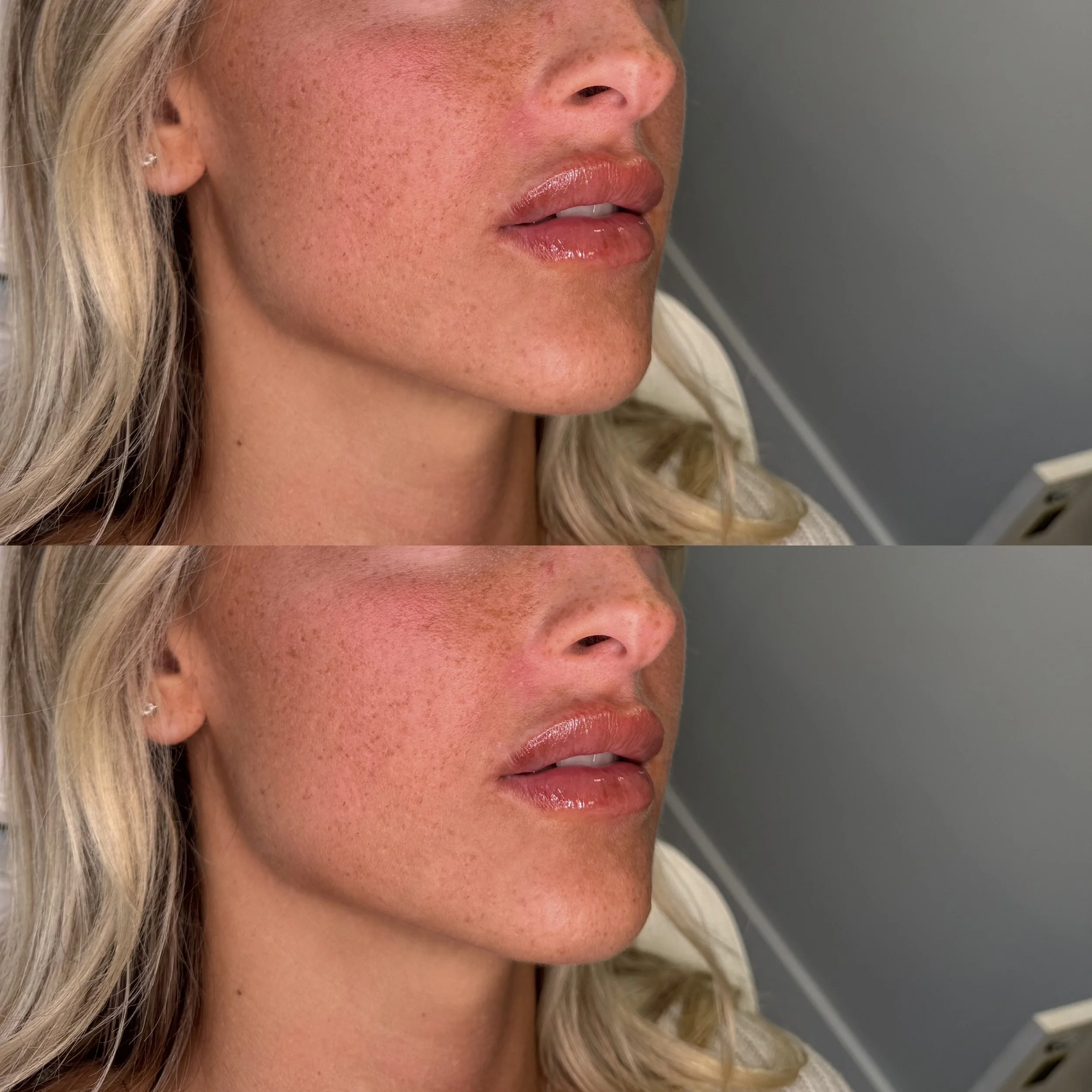 Close-up of a woman's face, showing her lips, cheek, and part of her nose, with visible freckles. The image is duplicated, with minor variations in lighting and skin tone.
