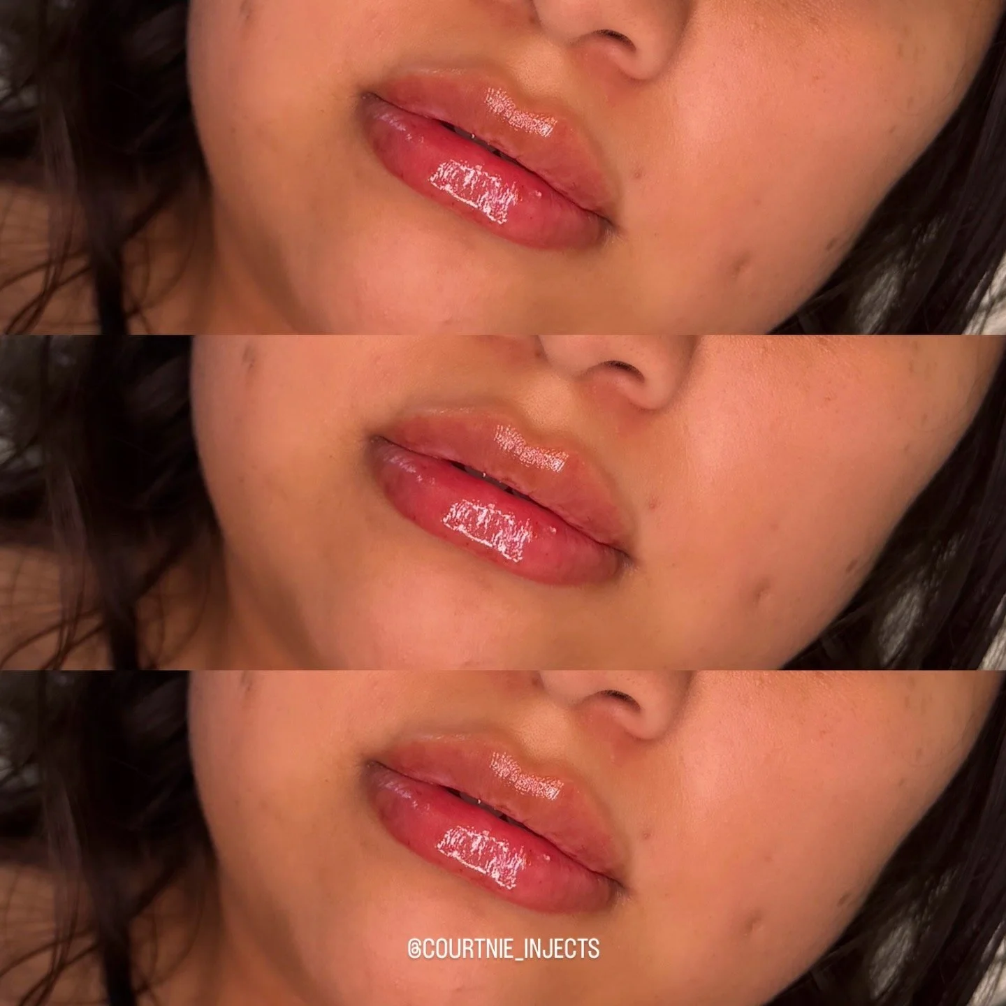 Close-up of a person's lips with glossy lipstick, repeated in three horizontal sections with slight variations. The person's face has some freckles and skin blemishes.