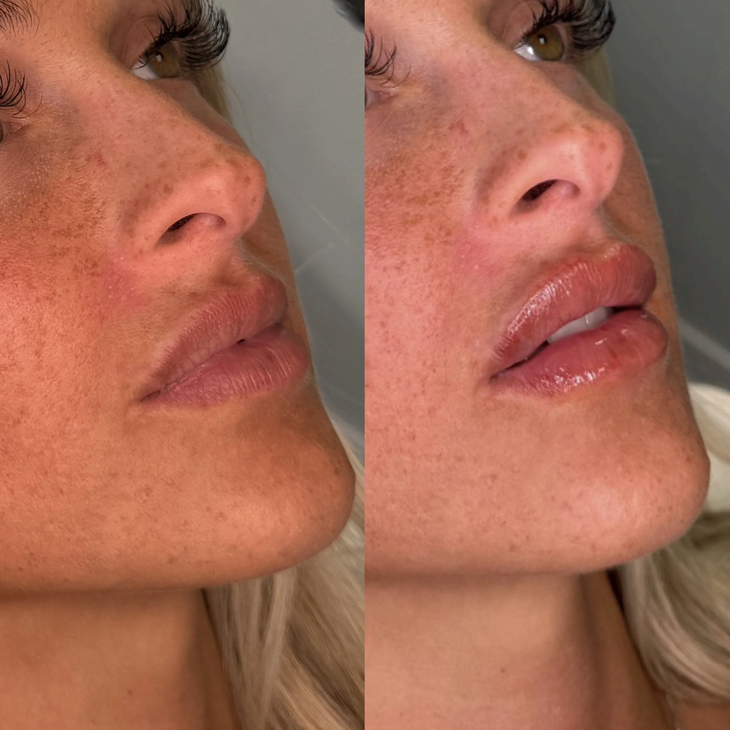 Close-up of a woman's face before and after lip gloss application, showing improved lip appearance.