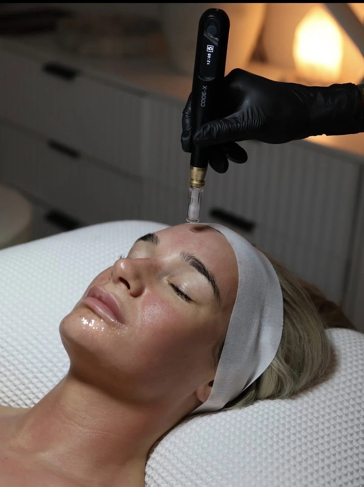 A woman receiving a facial treatment with advanced microneedling