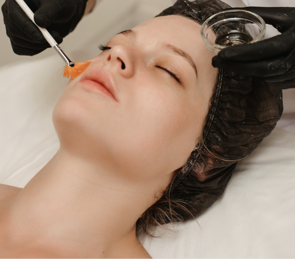 Facial chemical peel
