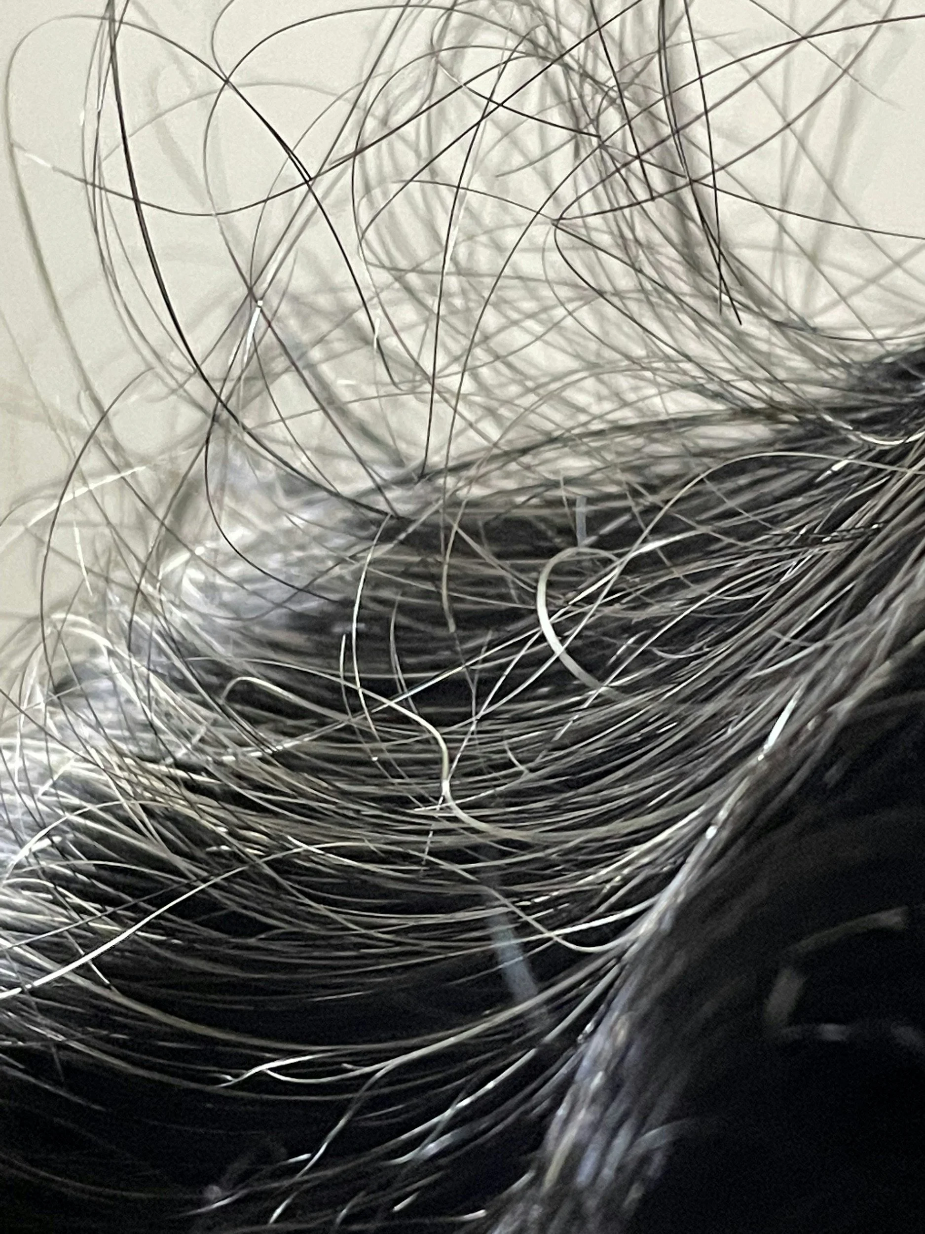 How Hair Restoration Works at Skin Theory