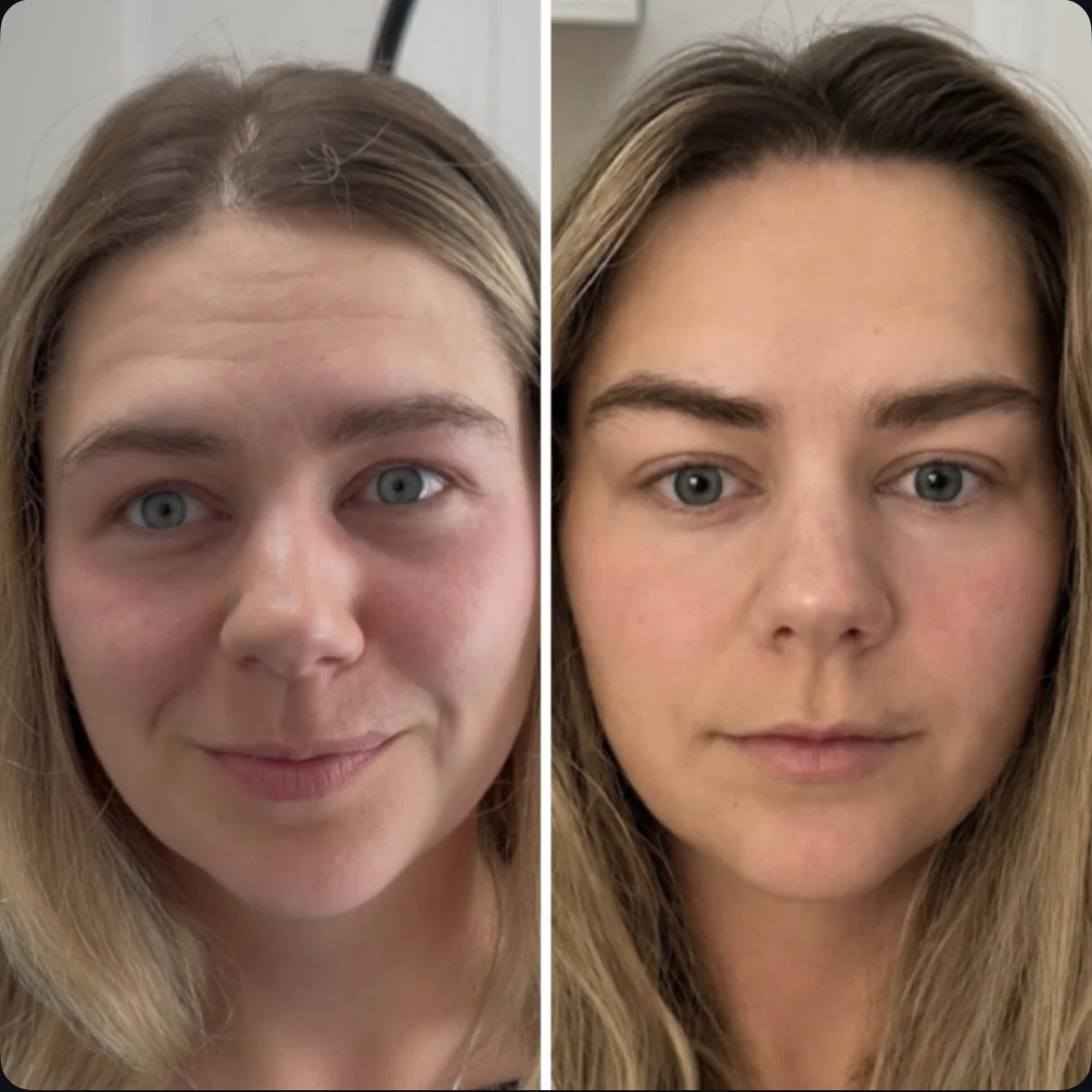 Side-by-side photos of a woman before and after skincare, showing smoother skin and a more even complexion in the second image.