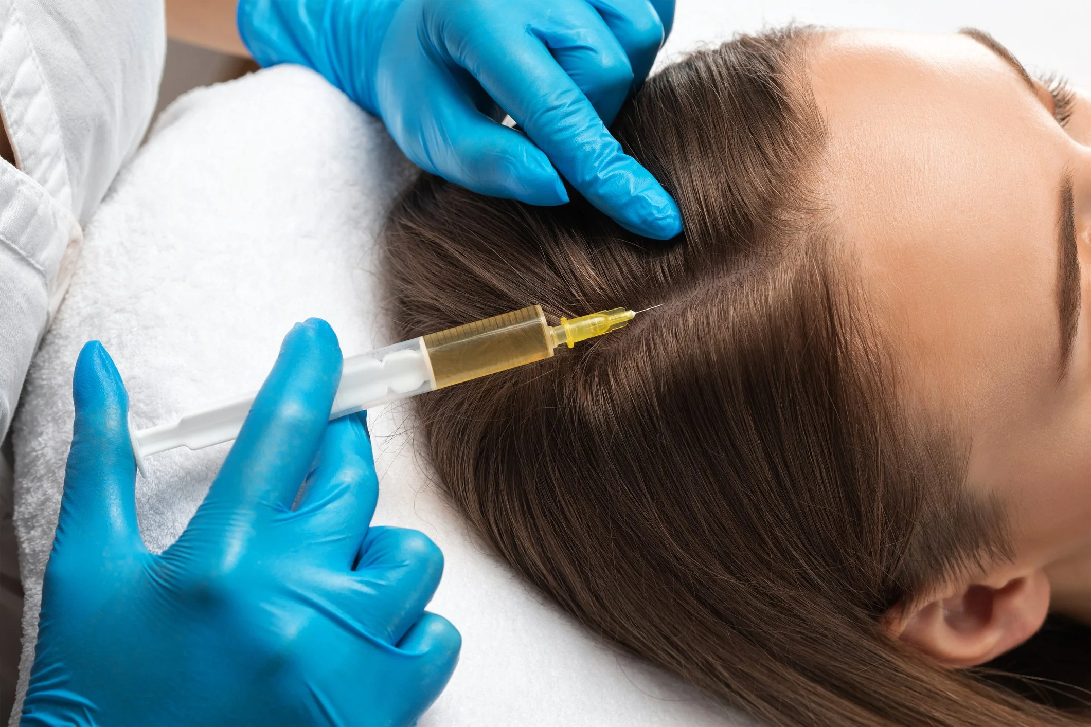 Hair Loss Treatment in Mount Kisco