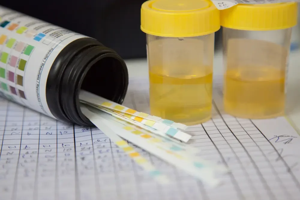 DOT URINE TESTING