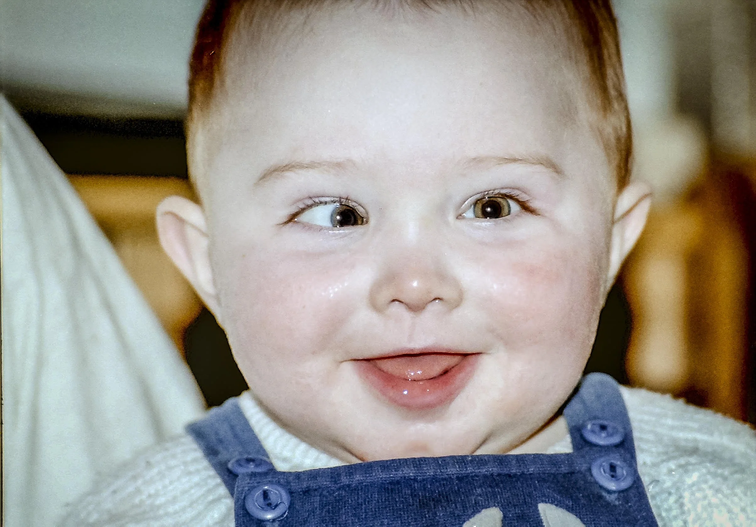 A young baby with vision problems requiring an assessment for vision therapy at Prof. Christian French - Consulting Neuro-Optometrist.