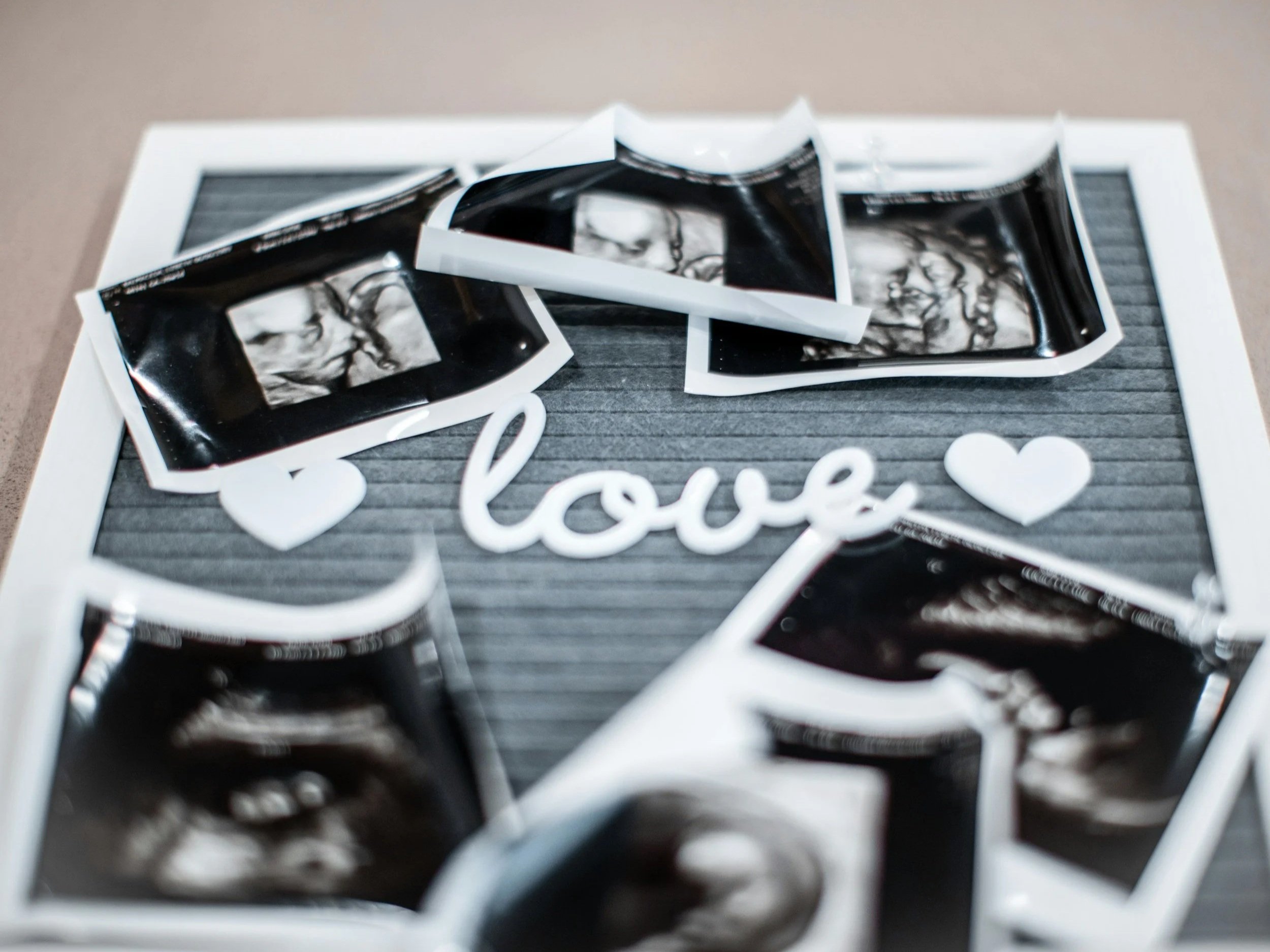 Everything You Need to Know About Ultrasound Scans in Pregnancy