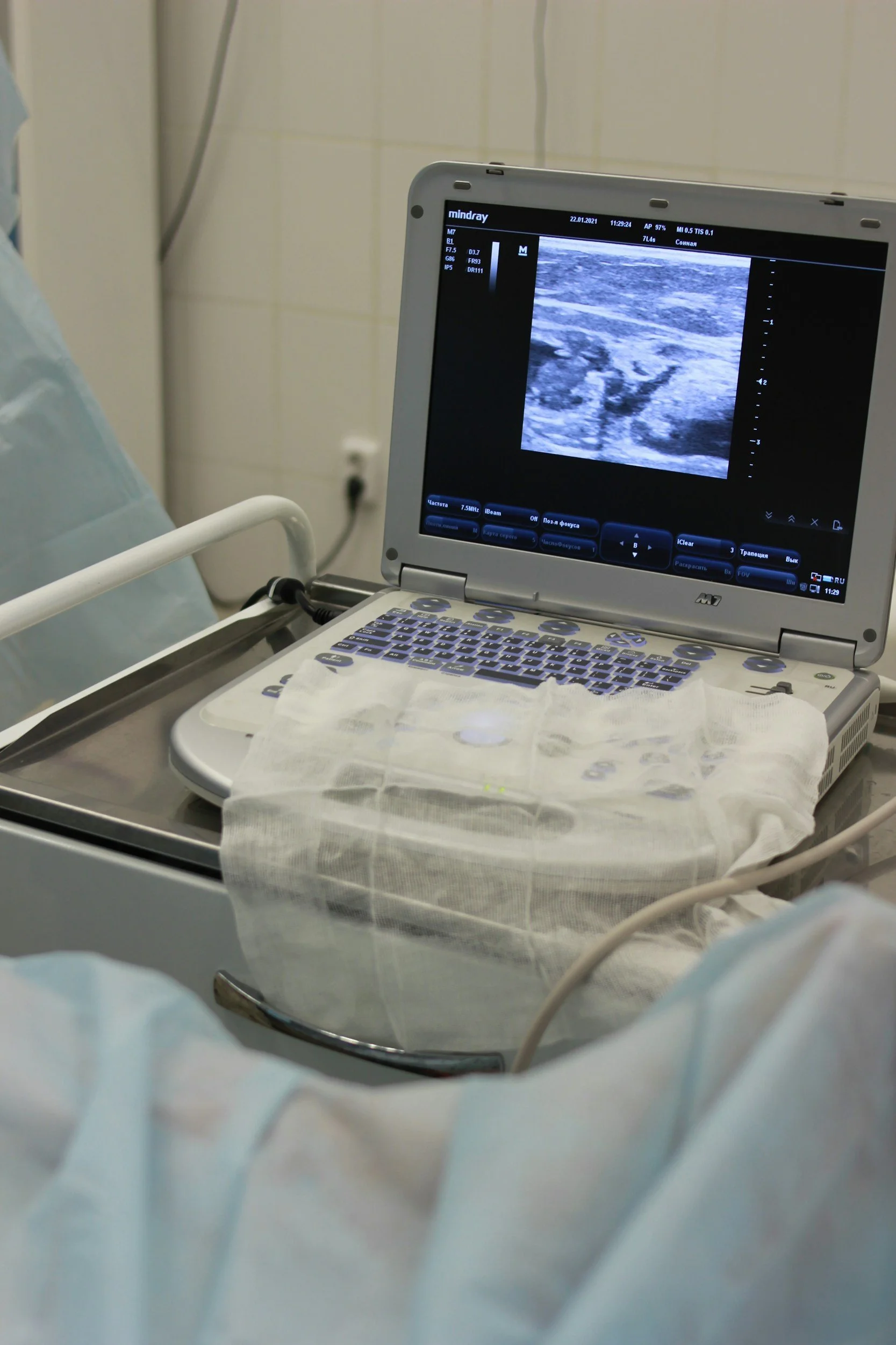 A veterinary ultrasound to diagnose pregnancy, cancer or tumors, internal bleeding, echocardiograms, and many other conditions in pets.