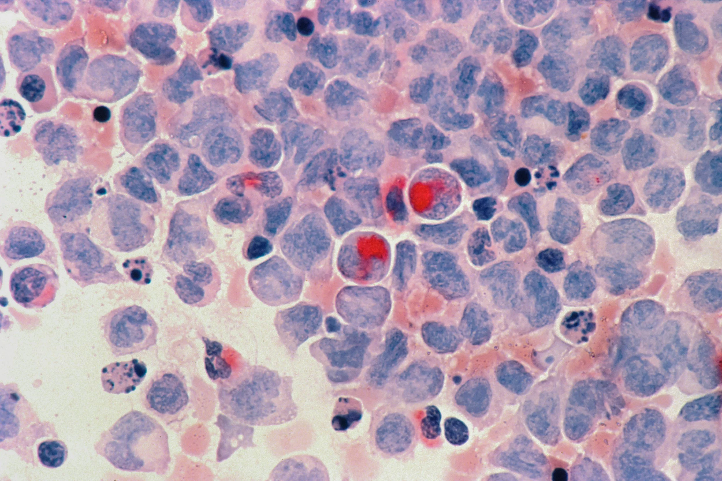 Microscope image of pet cancer treatment and diagnosis at Highview Veterinary Hospital in Boerne, Texas.