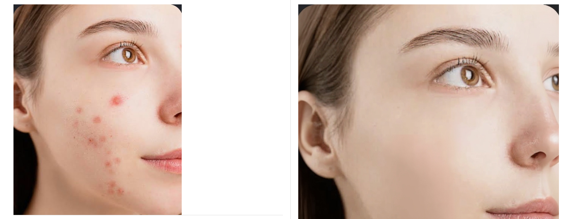How to Remove Blemishes from Photos with AI (2026 Guide)