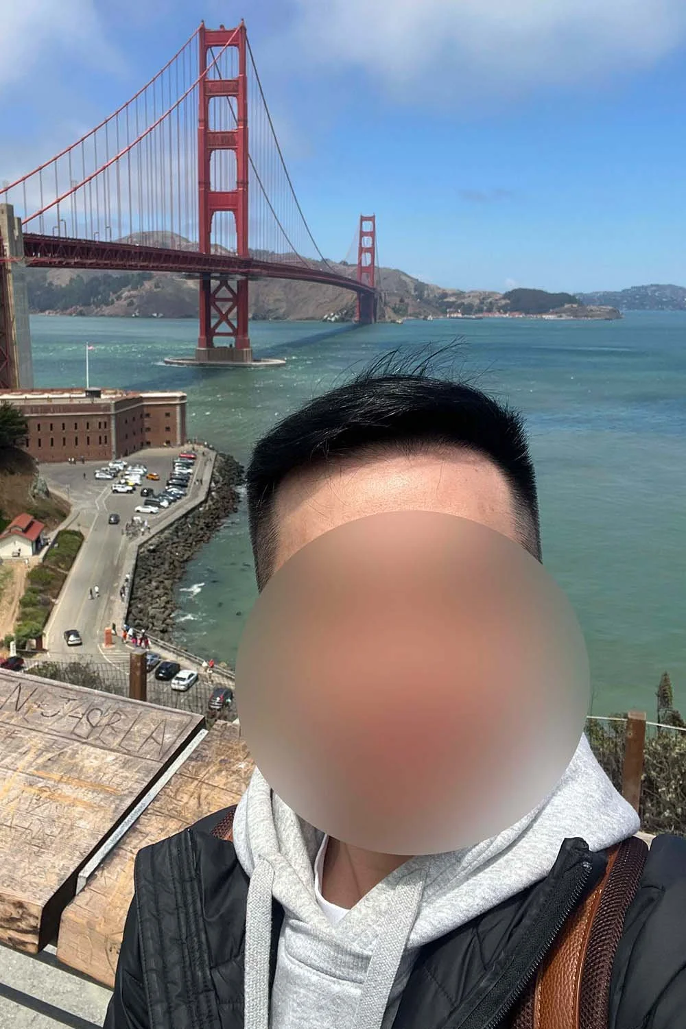 Zack in San Francisco 9 months after his hair transplant without a cap.