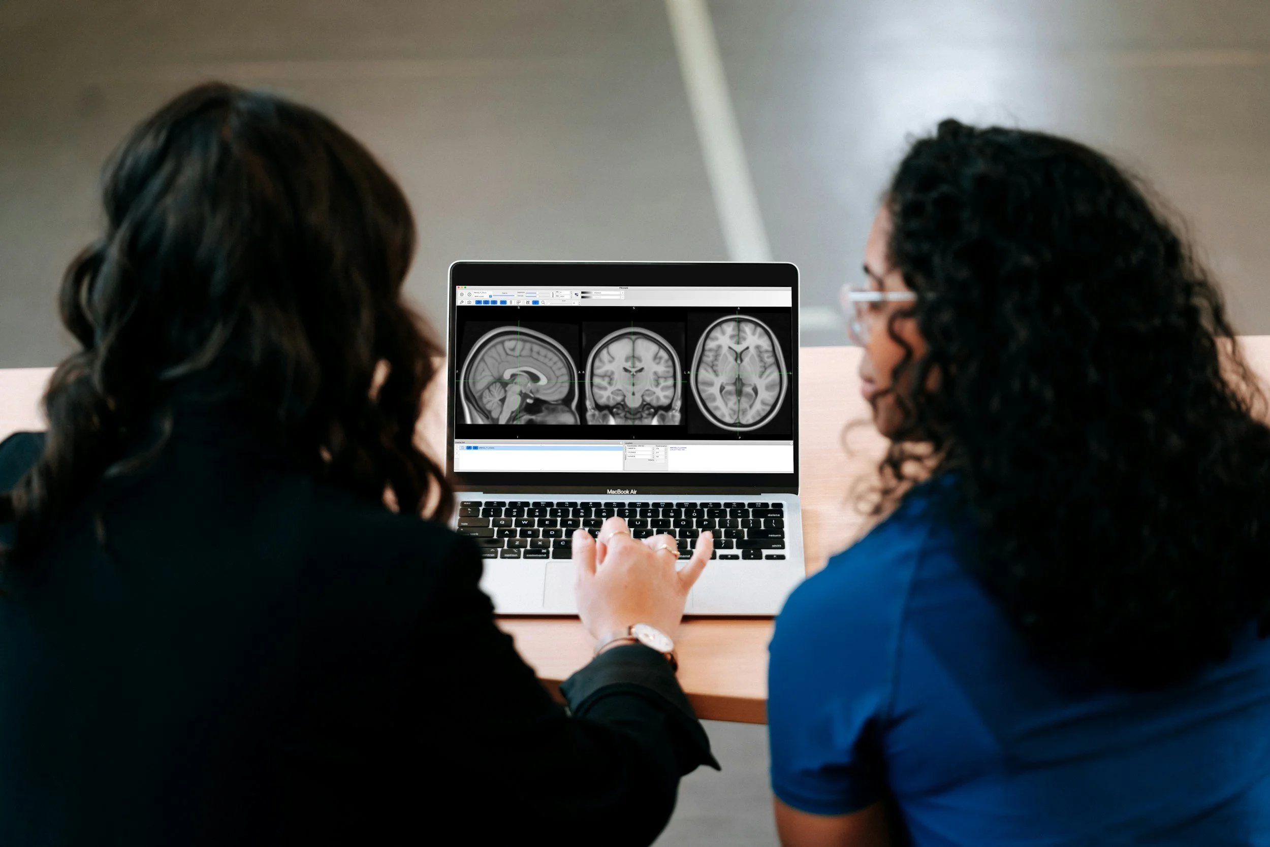 Two women examining brain MRI scans on a laptop in a discussion.