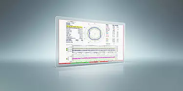 Medical monitor displaying brain scan data and graphs in a clinical setting.