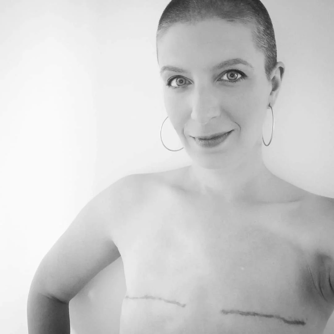 Portrait en noir et blanc d'une femme aux cheveux rasés, yeux clairs, souriant avec confiance, posant sans chandail pour montrer sa les cicatrices de sa mastectomie sans reconstruction.