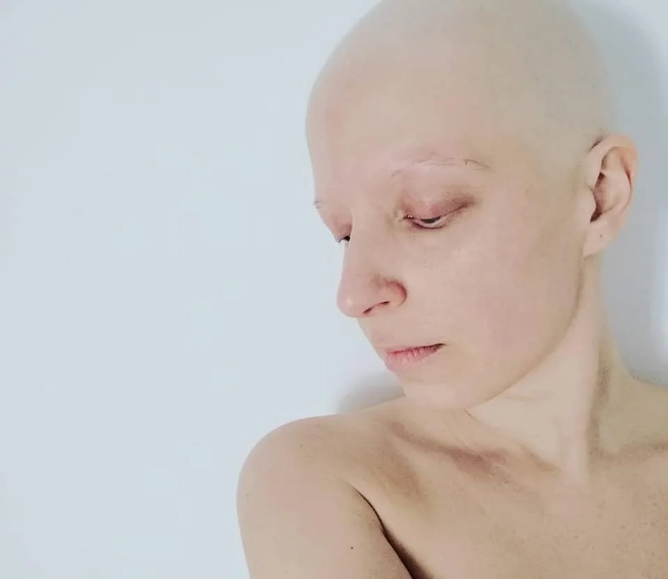 Portrait d'une personne avec une tête rasée, regardant vers le bas, sur un fond blanc.