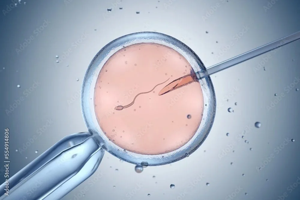 IVF support package