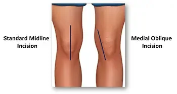 jiffy knee