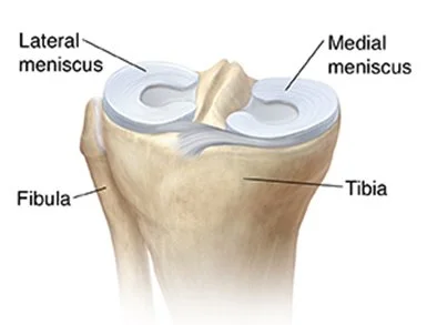 meniscus tear Expert Orthopaedic Care, Demorest, GA Kris Wheeler, MD