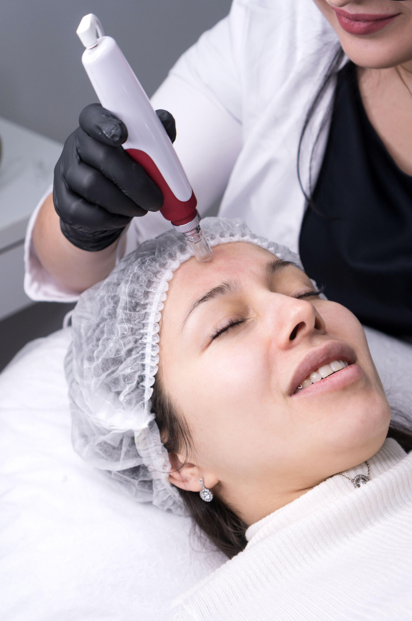 Client receiving a professional skin treatment using a microneedling device.