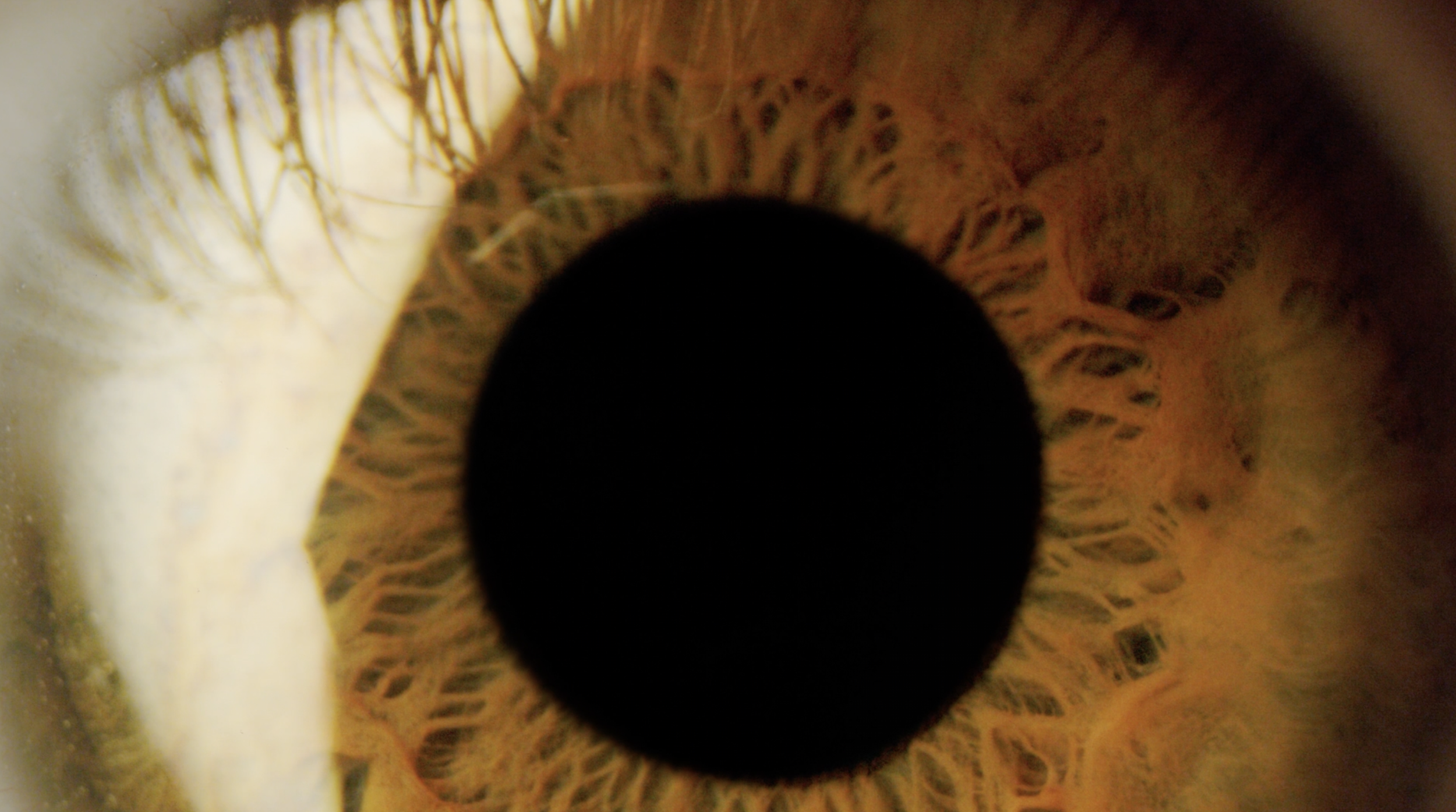 eye-pupil-dialating.png
