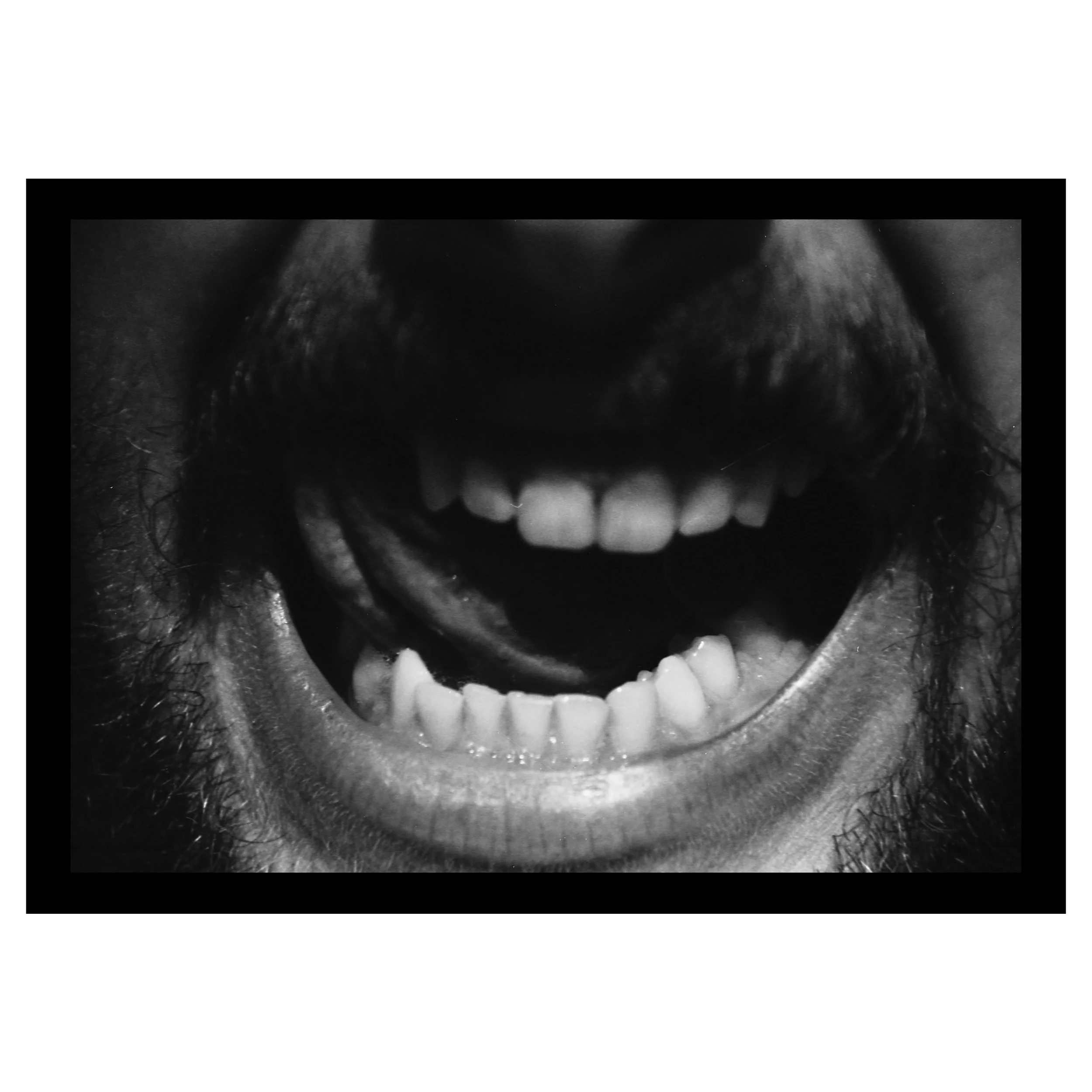 Teeth