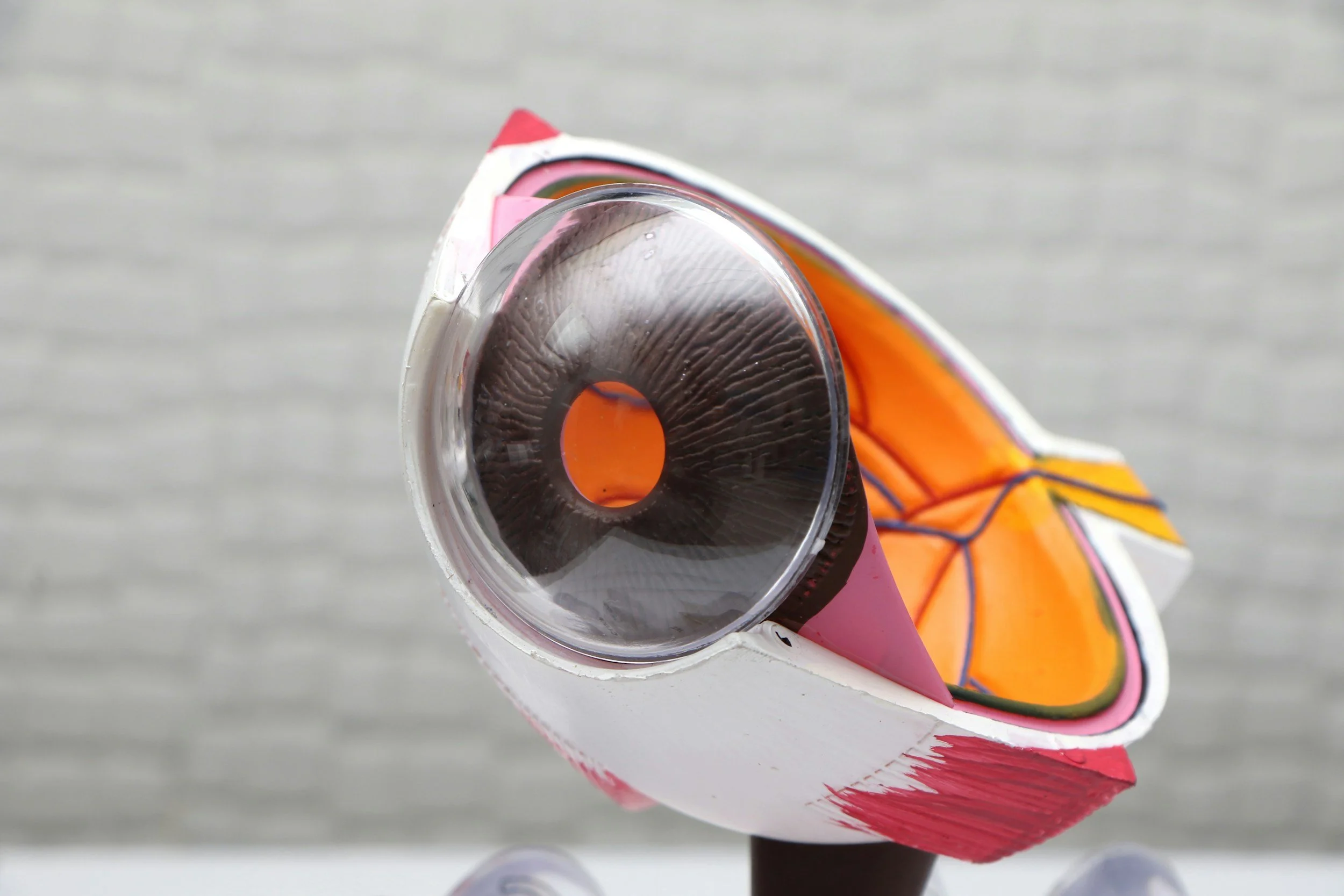 PRK vs. Trans-PRK: What's the Difference and Which Laser Eye Surgery Is Right for You?