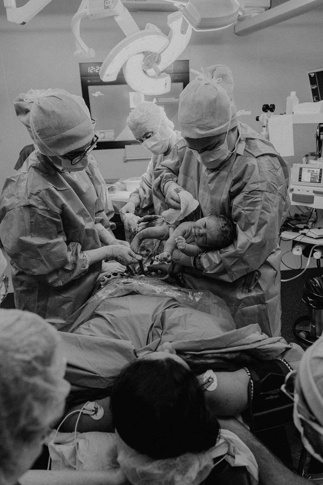 L’instant bouleversant de la naissance par césarienne, lorsque bébé vient au monde entouré de l’équipe médicale, capturé en reportage d’accouchement en Suisse romande avec émotion et respect.