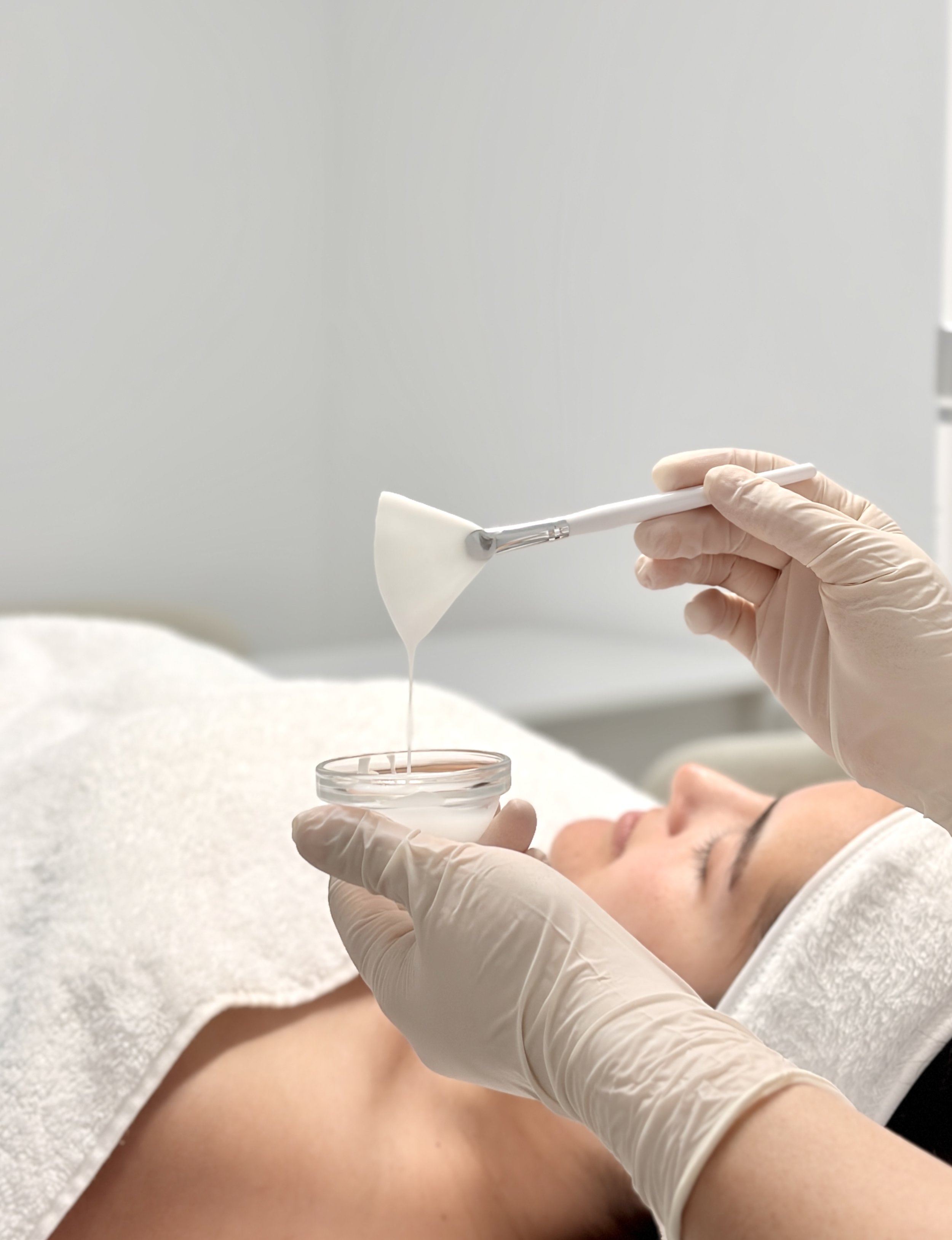 Chemische peelings verbeteren de huid door dode huidcellen te verwijderen. De huid wordt gladder en egaler. Pigmentvlekken en fijne lijntjes verminderen zichtbaar. Ook acne en grove poriën kunnen verbeteren.