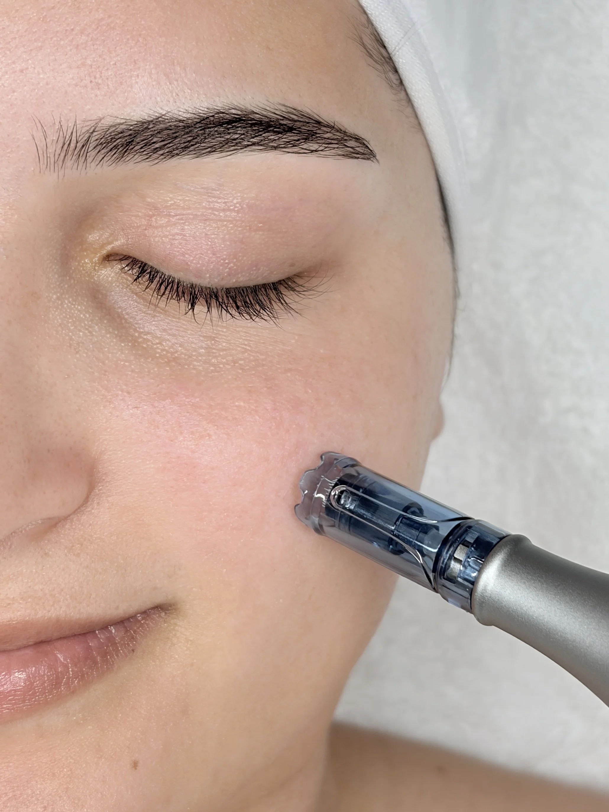 De PDRN behandeling met zalm DNA stimuleert celvernieuwing en huidherstel van binnenuit. Dit helpt bij huidveroudering, doffe huid, fijne lijntjes, littekens en zonschade, geeft de huid een gezonde glow.